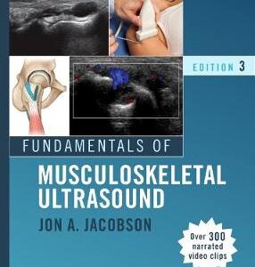 FUNDAMENTALS OF MUSCULOSKELETAL ULTRASOU