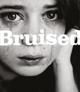 Bruised