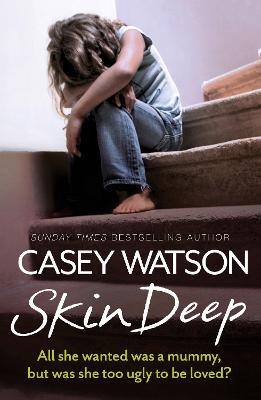 Skin Deep: All She Wanted Was A Mummy, But Was She Too Ugly To Be Loved?