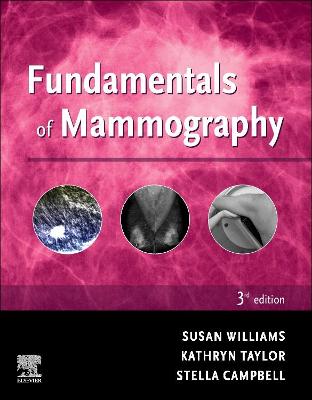 FUNDAMENTALS OF MAMMOGRAPHY
