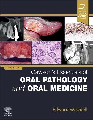CAWSON'S ESSENTIALS OF ORAL PATHOLOGY